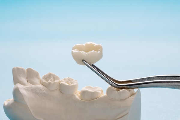 What To Do About A Loose Dental Crown