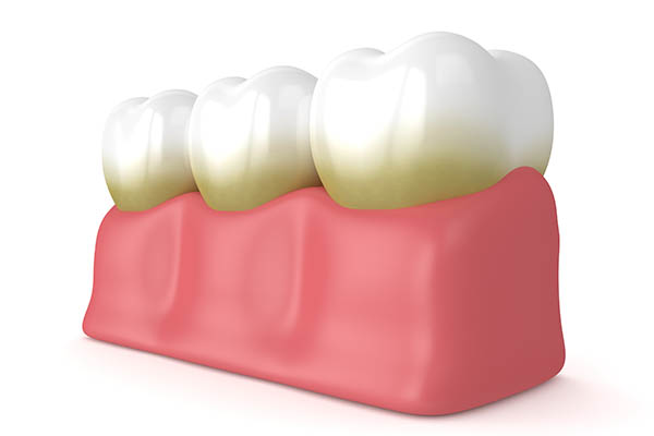 Preventative Dental Care Against Plaque and Tartar from Dentistry on Park, LLC in Stoughton, MA